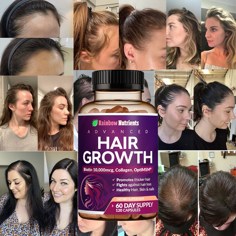 HAIR GROWTH
